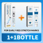 Blue Light Pen for Stretch Marks and Skincare Tools