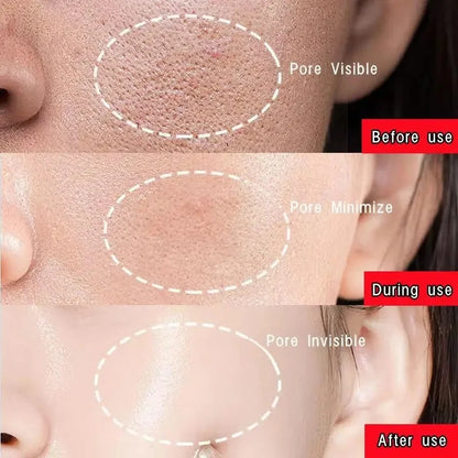 Green Tea Solid Mask for Acne and Blackhead Removal