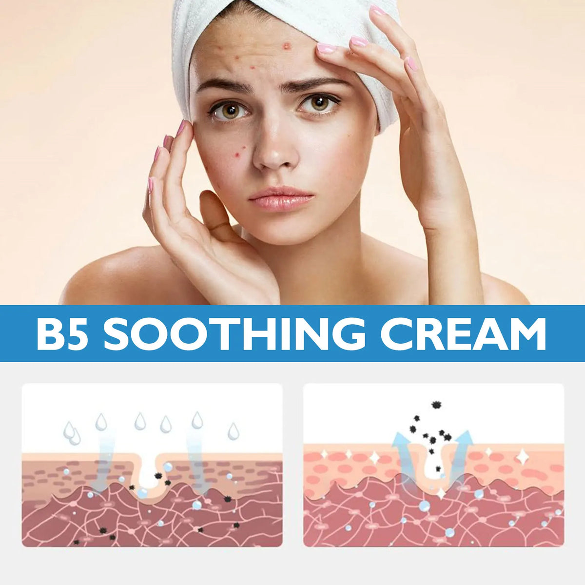 B5 Moisturizing Cream for Dry Chapped Skin