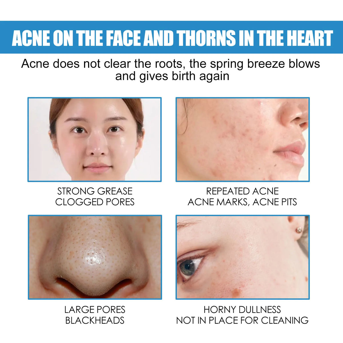 B5 Moisturizing Cream for Dry Chapped Skin