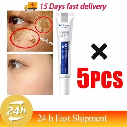 Effective Whitening Freckles Cream for Dark Spots