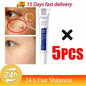 Effective Whitening Freckles Cream for Dark Spots