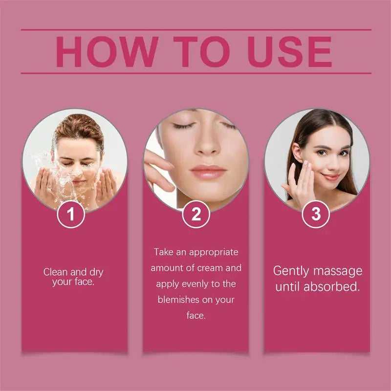 Nicotinamide Whitening Freckle Cream for Dark Spots