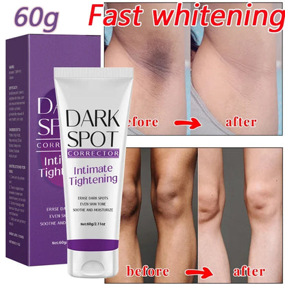 Body Whitening Cream for Private Parts and Underarms