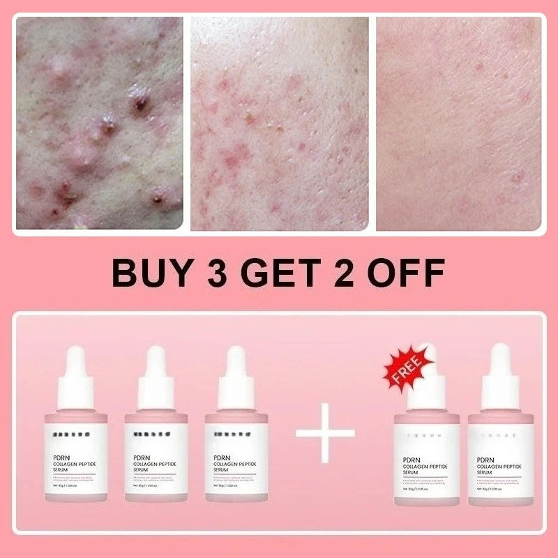 Collagen Peptide Facial Serum for Dull Skin