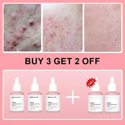 Collagen Peptide Facial Serum for Dull Skin
