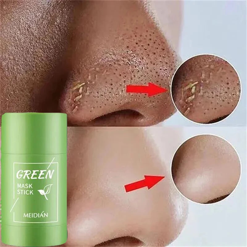 Green Tea Solid Mask for Acne and Blackhead Removal