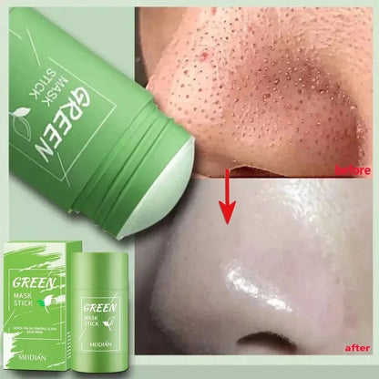 Green Tea Solid Mask for Acne and Blackhead Removal