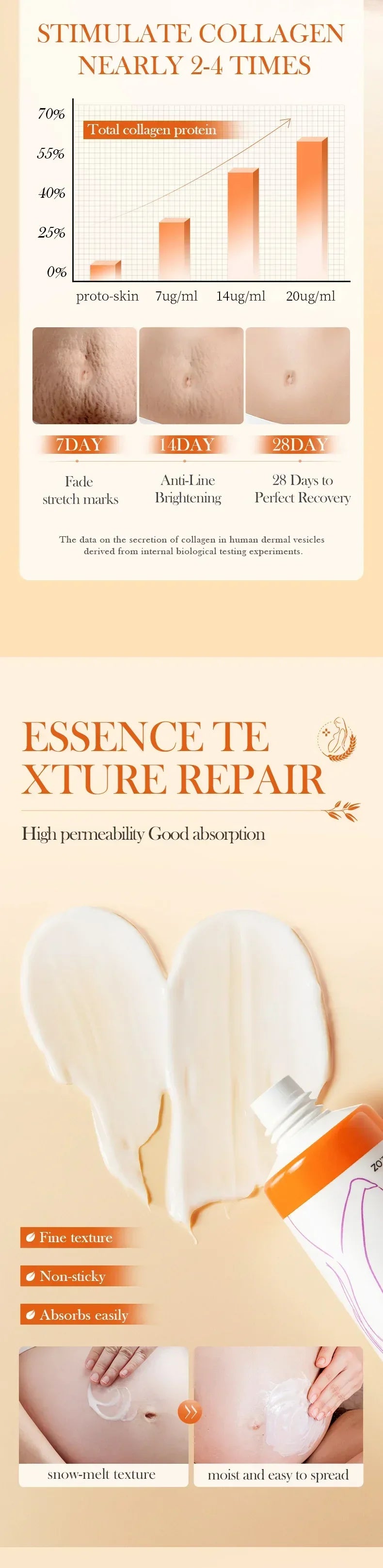 Stretch Mark Removal Cream for Postpartum Care
