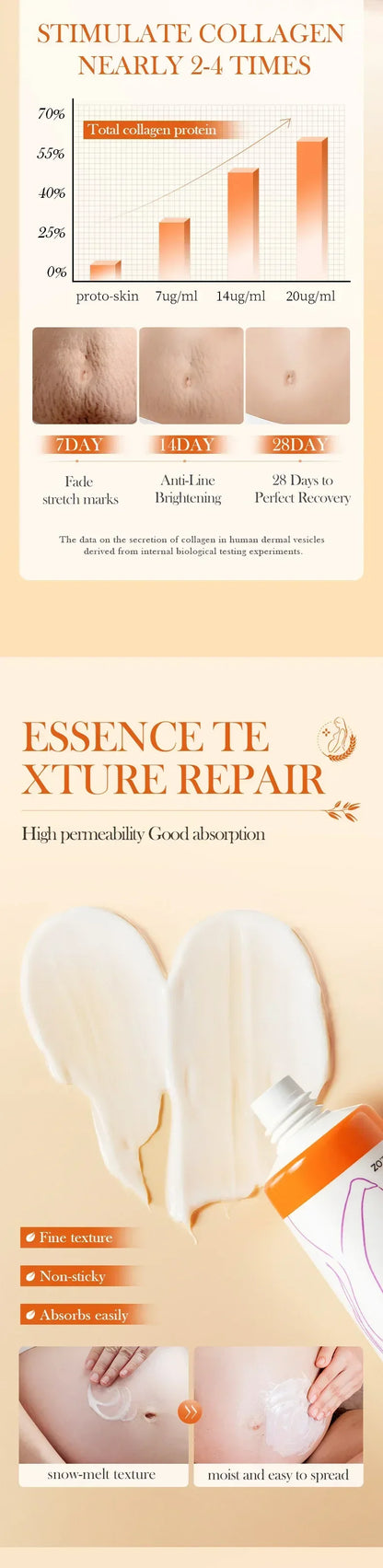 Stretch Mark Removal Cream for Postpartum Care