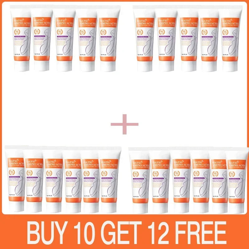 Stretch Mark Removal Cream for Postpartum Care