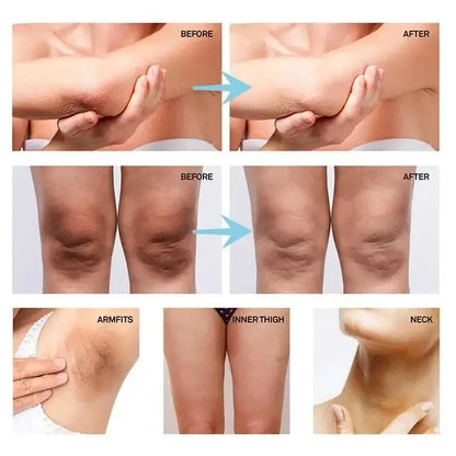 Body Whitening Cream for Private Parts and Underarms