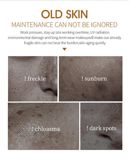 Effective Whitening Freckles Cream for Dark Spots