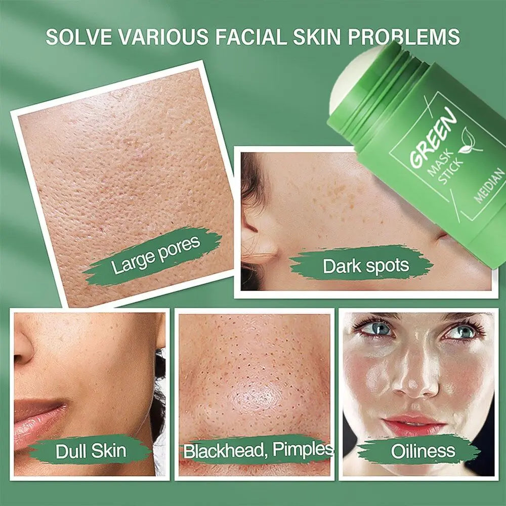 Green Tea Solid Mask for Acne and Blackhead Removal