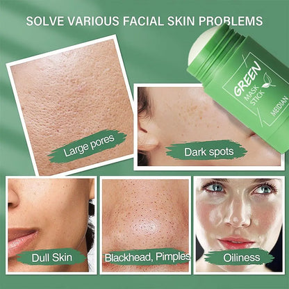 Green Tea Solid Mask for Acne and Blackhead Removal