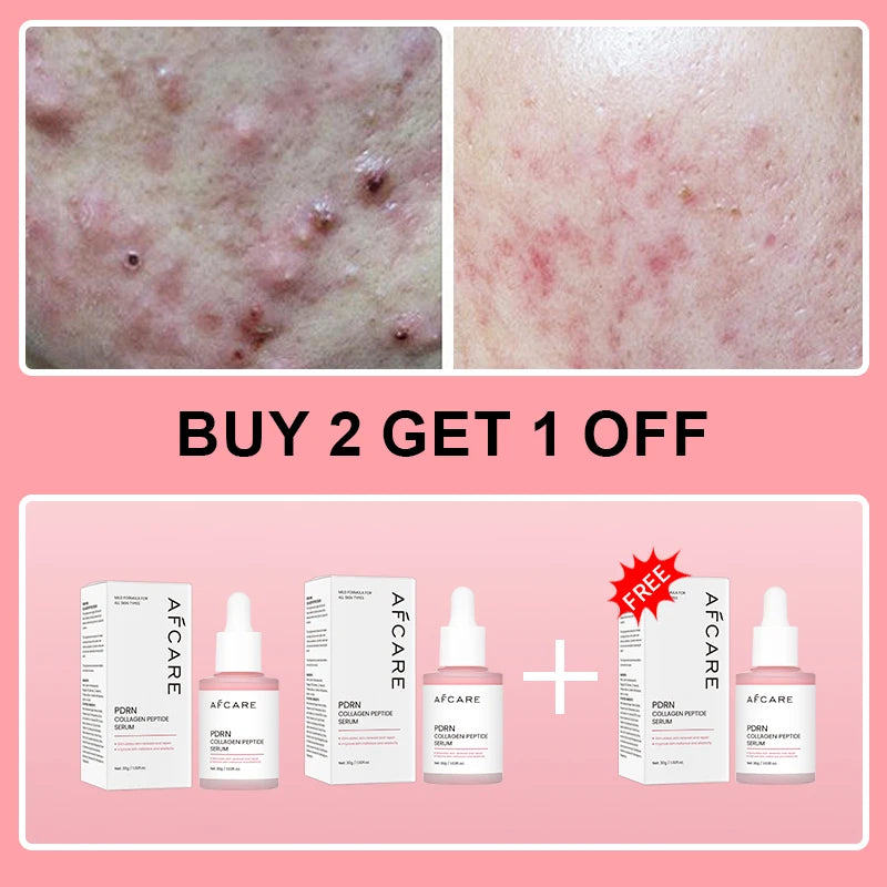 Collagen Peptide Facial Serum for Dull Skin