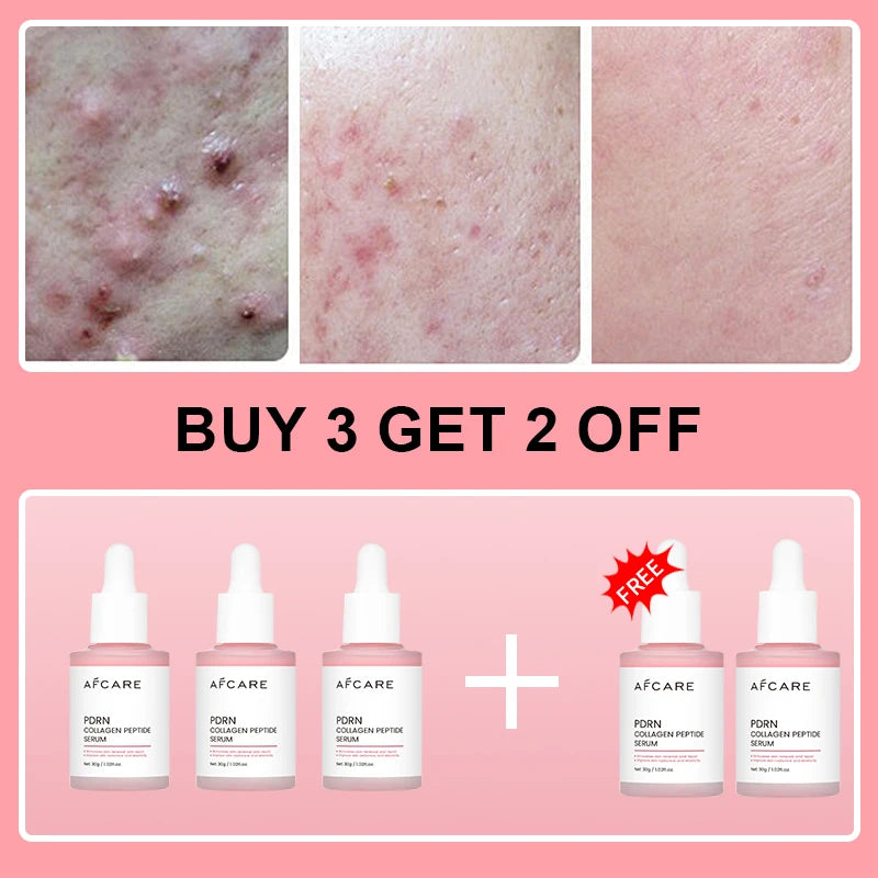 Collagen Peptide Facial Serum for Dull Skin