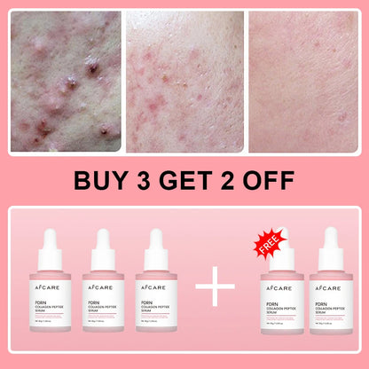 Collagen Peptide Facial Serum for Dull Skin
