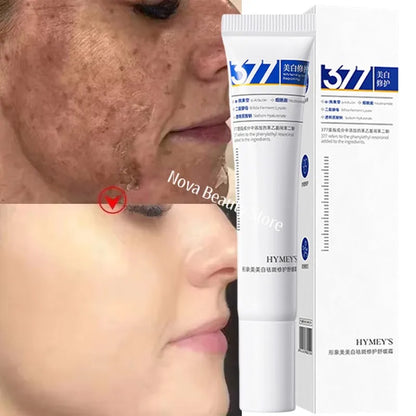 Effective Whitening Freckles Cream for Dark Spots