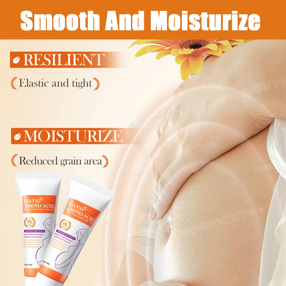 Stretch Mark Removal Cream for Postpartum Care