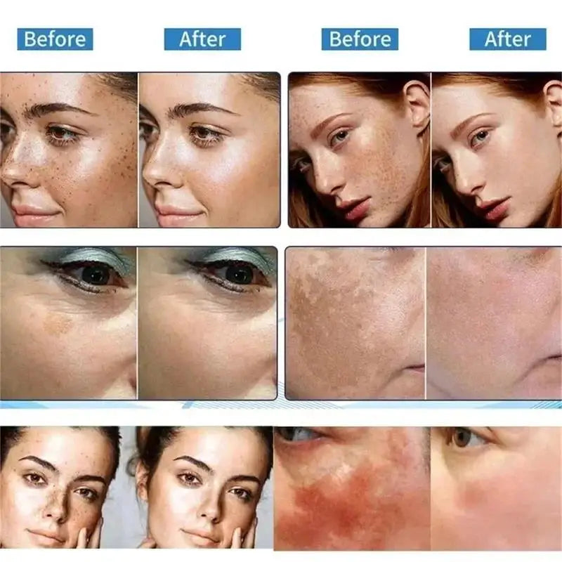 Nicotinamide Whitening Freckle Cream for Dark Spots