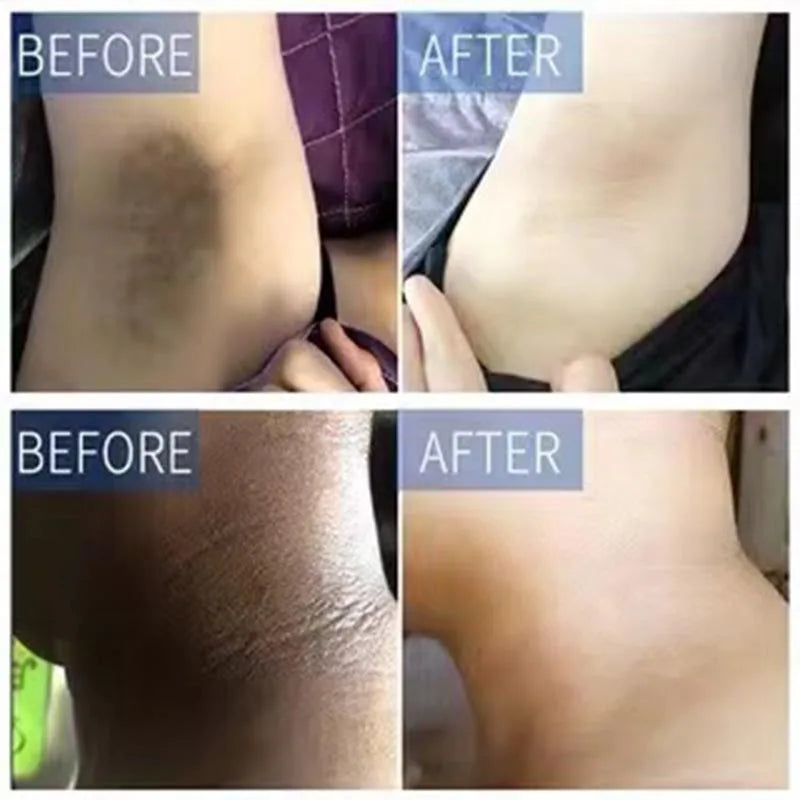 Body Whitening Cream for Private Parts and Underarms