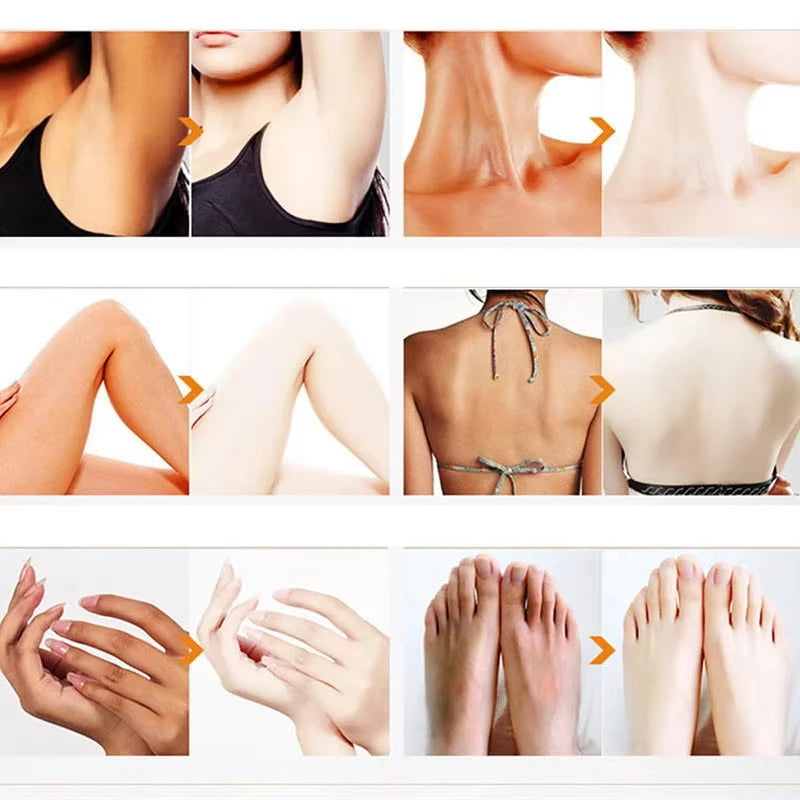 Body Whitening Cream for Arms, Thighs, and Underarms
