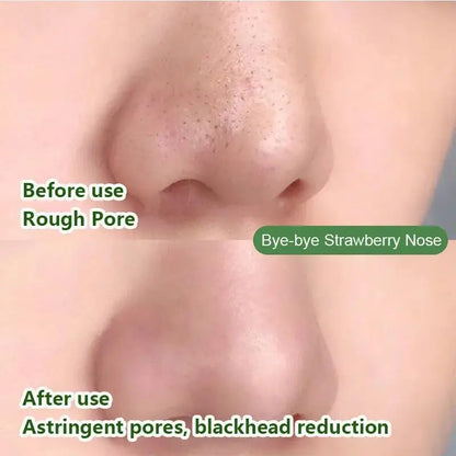 Green Tea Solid Mask for Acne and Blackhead Removal