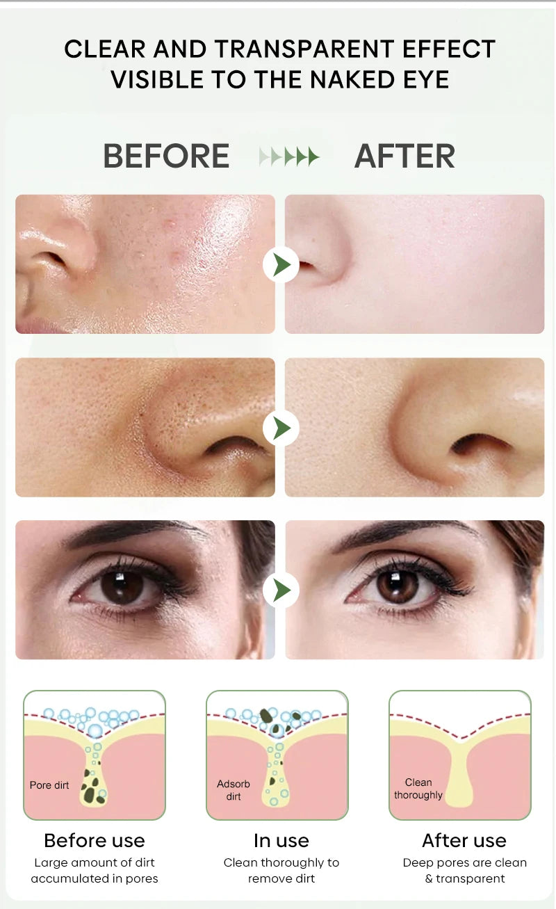 Green Tea Solid Mask for Acne and Blackhead Removal