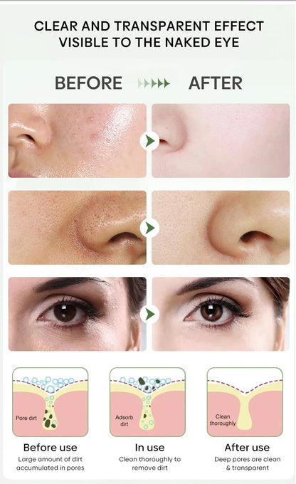 Green Tea Solid Mask for Acne and Blackhead Removal