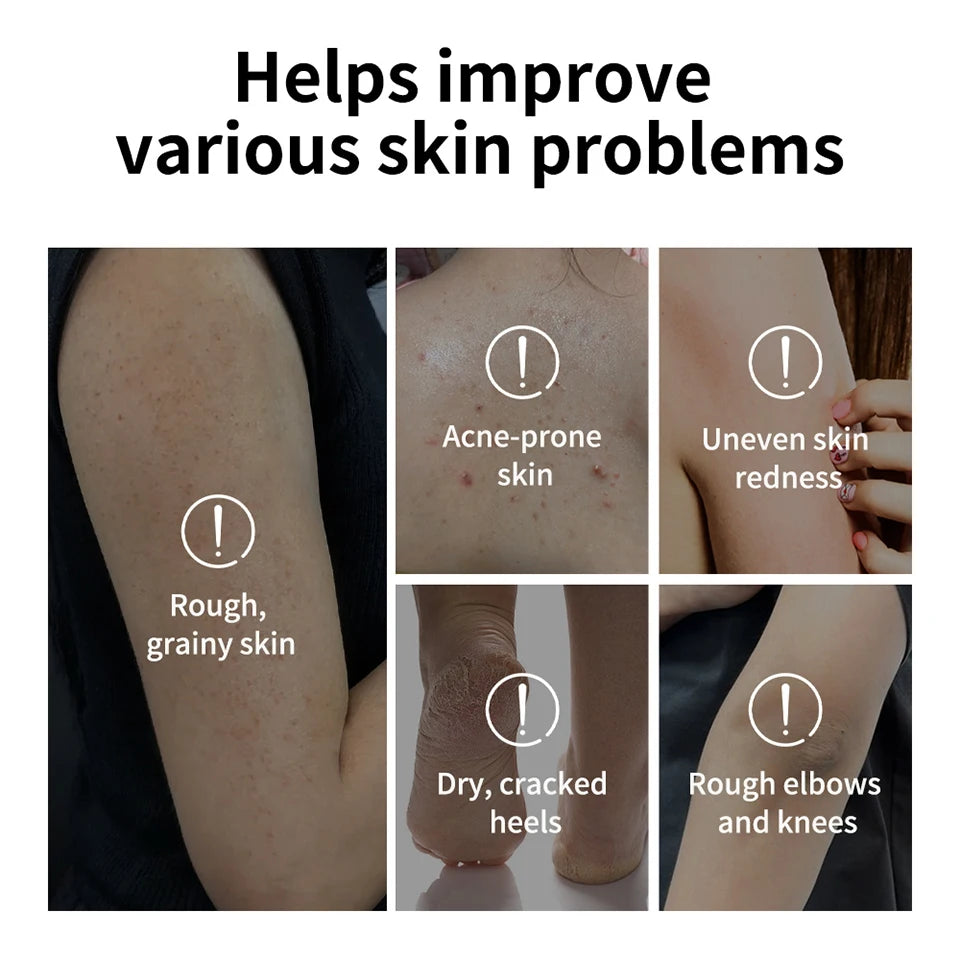 Glycolic Acid Exfoliating Body Stick 18g