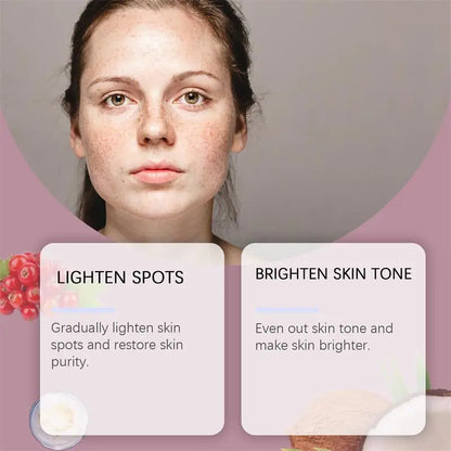 Nicotinamide Whitening Freckle Cream for Dark Spots