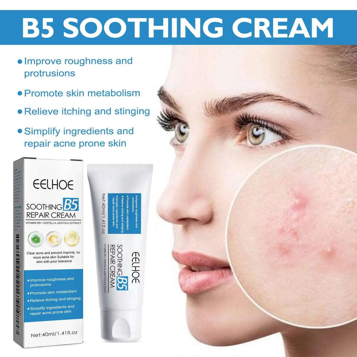 B5 Moisturizing Cream for Dry Chapped Skin